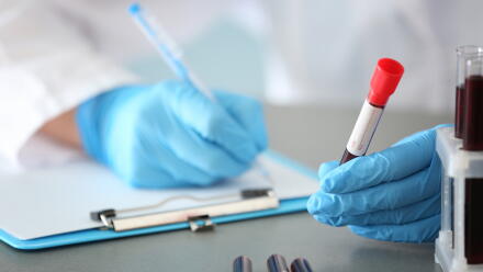 news thumbnail image